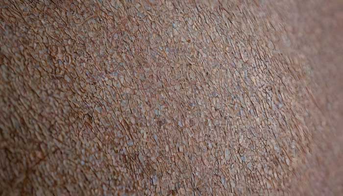 Tragbare Gesundheitstechnologien: Photonik am Handgelenk